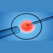intrauterine insemination (iui) - artificial insemination in utsav fertility center panvel, navi mumbai