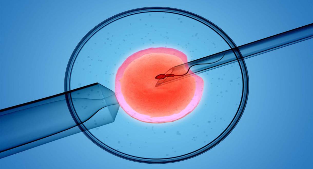 intrauterine insemination (iui) - artificial insemination in utsav fertility center panvel, navi mumbai