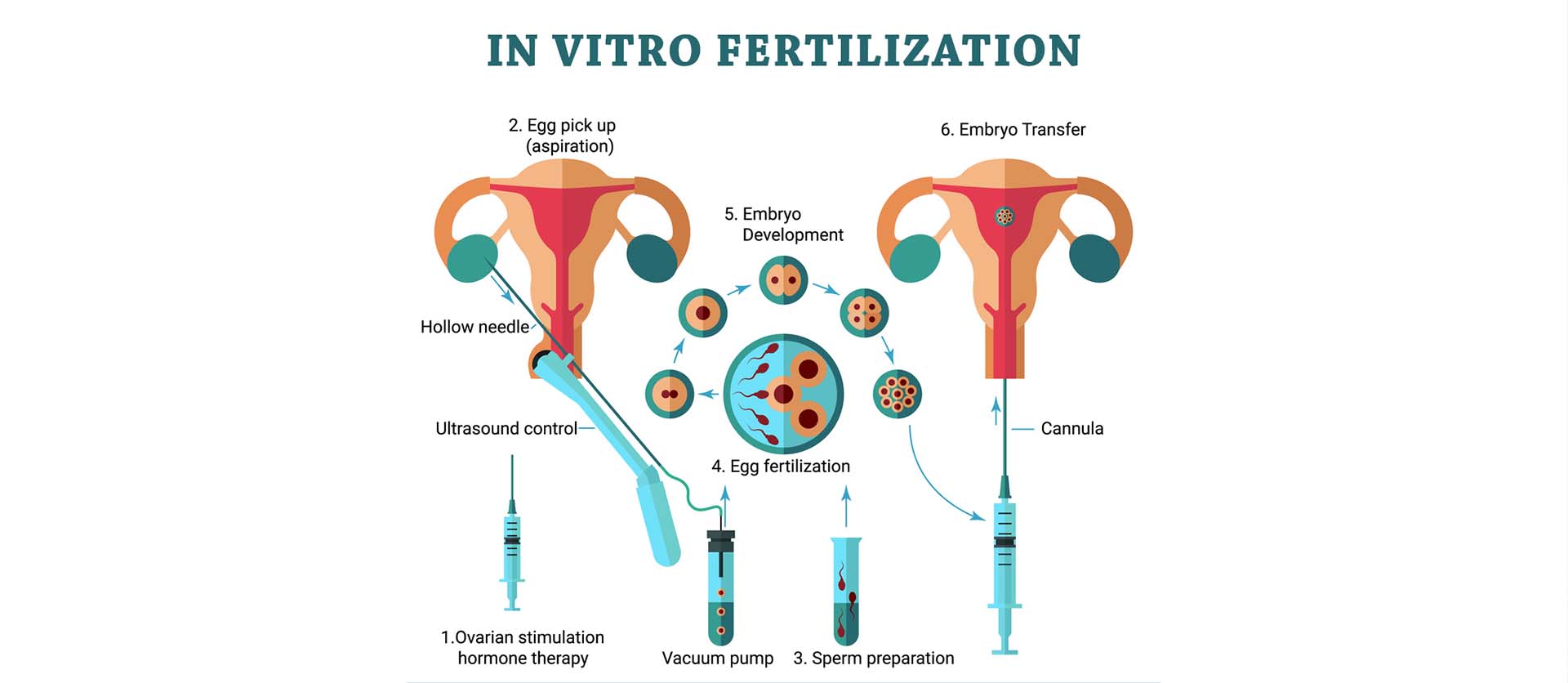 treatment process for ivf in utsav fertility center in panvel, navi mumbai